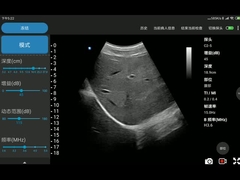 Android ve iOS Sistemiyle Uyumlu CE İşaretli 3.6MHz Konveks Prob