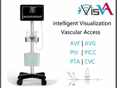Ultrason eşliğinde PTA