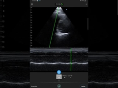 256 Tarama Hatları Ipad Ultrason Dönüştürücü PICC için Kablosuz Ultrason Probu