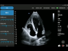 3.6MHz Taşınabilir Kablosuz Ultrason Probu Phased Array Dönüştürücü
