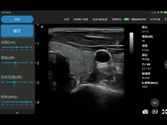 256 Tarama Hatları Ipad Ultrason Dönüştürücü PICC için Kablosuz Ultrason Probu