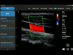 12MHz Kablosuz Iphone Ultrason Tarayıcıları Elektronik Doğrusal Dizi