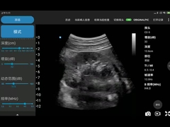 CE İşaretli 3.6MHz Taşınabilir Wifi Ultrason Tarayıcılar JPEG BMP PNG MPEG-4