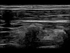 WiFi 12.6cm Uzaktan Taşınabilir Doppler Ultrason Makinesi 30 Fps