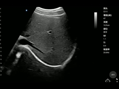 ISO13485 Taşınabilir Tıbbi Cihaz Dışbükey Prob El Sağlık Tarayıcısı