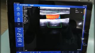 128 Elemanlı Çift Kafalı Kablosuz Ultrason Probu