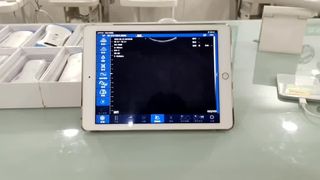 Kadın Doğum Teşhisi için Çift Kafalı Kablosuz Ultrason Probu
