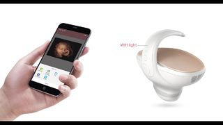 Marvoto Fetus Kamera M1- 3D El Tipi Ultrason