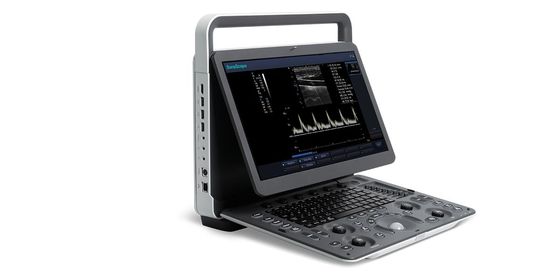 satın al 15.6 inç LED SonoScape Taşınabilir Renkli Doppler Ultrason Makinesi BW Ultrason online manufacture