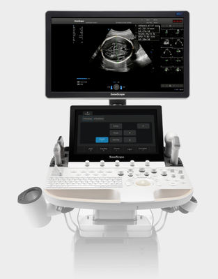 satın al Yapay Zeka Tabanlı SonoScape Ultrason Makine Arabası P60 Exp online manufacture