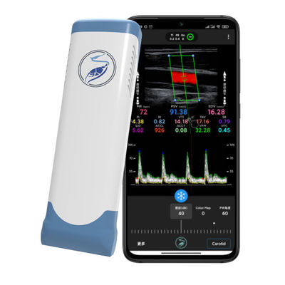 satın al iPhone ve iPad için 12MHz Kablosuz El Tipi Ultrason Tarayıcı | Elektronik Doğrusal Dizi Renkli Doppler Probu online manufacture