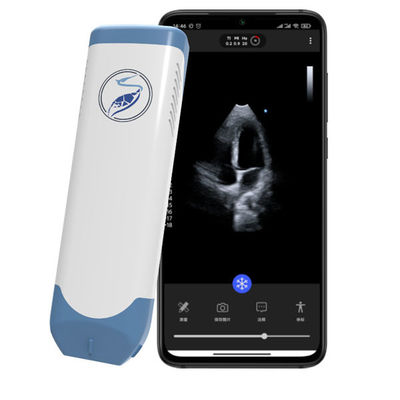 satın al POCUS Ekokardiyografi için Kablosuz Fazlı Dizi El Tipi Ultrason Tarayıcı 5MHz Cep Kardiyak Ultrason online manufacture