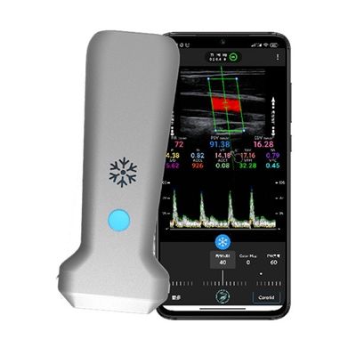satın al WiFi Kablosuz Doğrusal El Tipi Renkli Doppler Ultrason Tarayıcı | 30 FPS Gerçek Zamanlı Görüntüleme | Taşınabilir Tıbbi Ultrason Probu online manufacture