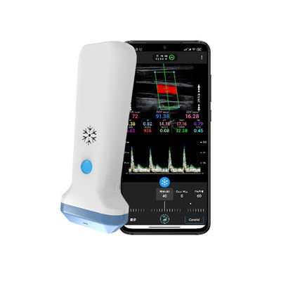 satın al Kablosuz Doğrusal El Ultrason Tarayıcısı | 4/8.3/12MHz Taşınabilir Renkli Doppler Ultrason Probu online manufacture