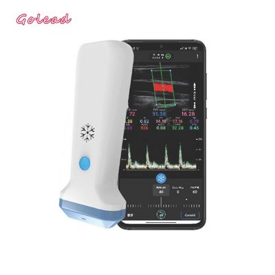 satın al Iphone için 12MHz 3000mAh Kablosuz Prob Tipi Ultrason Tarayıcı online manufacture