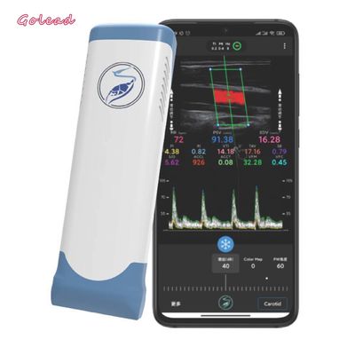 satın al Elektronik Doğrusal Dizi Wifi Kablosuz Taşınabilir Ultrason Tarayıcı 12MHz online manufacture