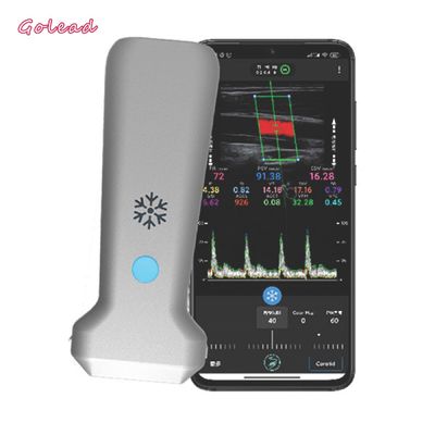 satın al Vasküler MSK Siniri İçin 126mm Dışbükey Prob Ultrason Tarayıcı online manufacture