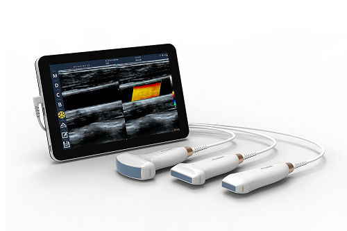 satın al USB Tip-C Doğrusal El Tipi Ultrason Tarayıcı Vasküler ve POCUS için 10MHz Taşınabilir Android Ultrason Probu online manufacture