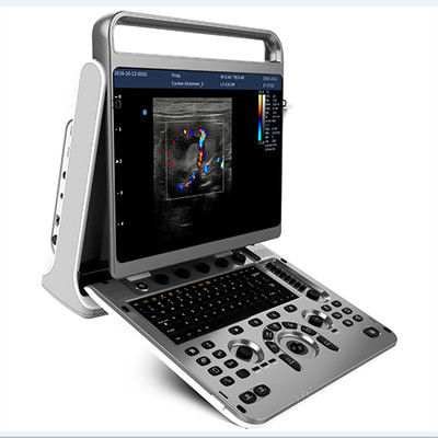 satın al Ergonomik Tasarım Portatif Ultrason Makinesi Chison EBit 30 online manufacture