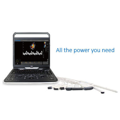 satın al Kardiyovasküler İçin 128 Element Wifi Ultrason Chison EBit 60 online manufacture