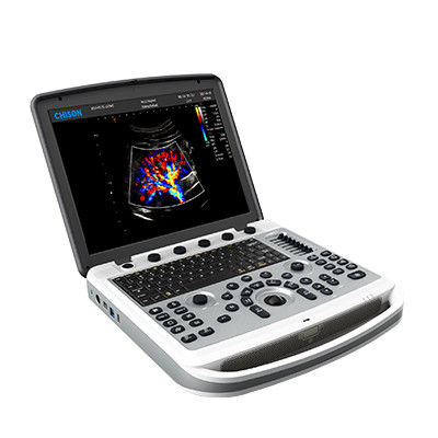 satın al 120° Dönebilen Chison SonoBook 6 Taşınabilir Dizüstü Ultrason Makinesi online manufacture