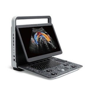 satın al Panoramik Görüntüleme SonoScape E2 PRO Taşınabilir Ultrason Makinesi online manufacture