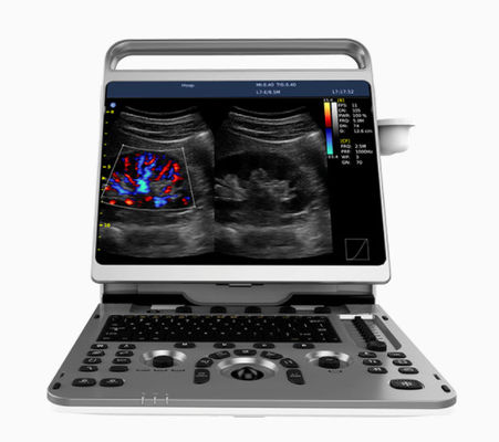 satın al Taşınabilir Kardiyak Ultrason Makinesi Chison EBit 50 16,5 lbs online manufacture
