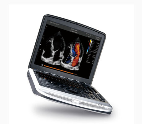 satın al Ekokardiyografi için FDA Onaylı Dizüstü Ultrason Makinesi Chison SonoBook 8 online manufacture