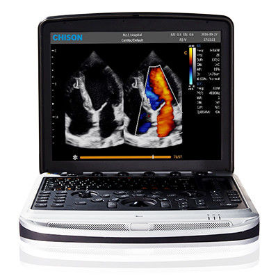satın al Taşıması Kolay 4D Chison SonoBook 9 Dizüstü Ultrason Makinesi online manufacture