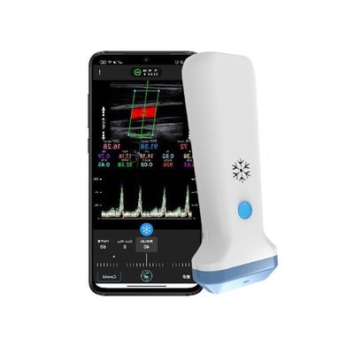 satın al Taşınabilir Renkli Doppler Kablosuz Doğrusal Ultrason Tarayıcı 12.6 cm Sağlık Profesyonelleri için El Tipi POCUS Ultrason online manufacture