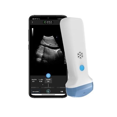 satın al HDMI çıkışı Kablosuz Konvesse El Ultrason Tarayıcı 3.6MHz Portatif Renk Doppler POCUS Ultrason online manufacture