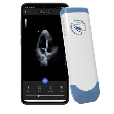 satın al Iphone 3.6MHz için Derinlik 18.9cm El Ultrason Tarayıcı online manufacture