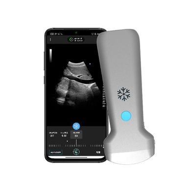 satın al ISO13485 Kablosuz Dışbükey El Tipi Ultrason Tarayıcı | Taşınabilir Renkli Doppler Ultrason Probu online manufacture