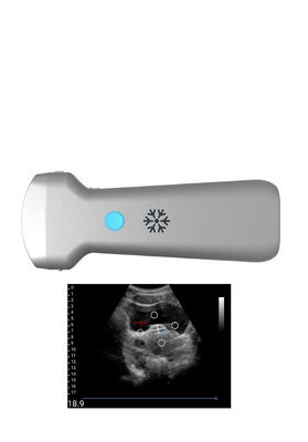 satın al Jinekoloji için Ultrasonication Dışbükey Kablosuz Ultrason Probu online manufacture