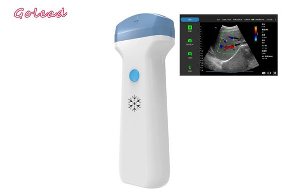 satın al POCUS Sınavları için Anestezi Ipad Kablosuz Ultrason Probu Birinci Basamak online manufacture