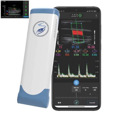 satın al 256 Tarama Hatları Ipad Ultrason Dönüştürücü PICC için Kablosuz Ultrason Probu online manufacture