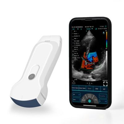 satın al POCUS Taşınabilir IPad Klinik Tanı İçin Taşınabilir Ultrason Tarayıcı online manufacture