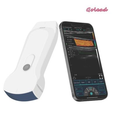 satın al 12 Ay Garanti El Tipi Ultrason Tarayıcı 128 Element wifi Ultrason USG online manufacture