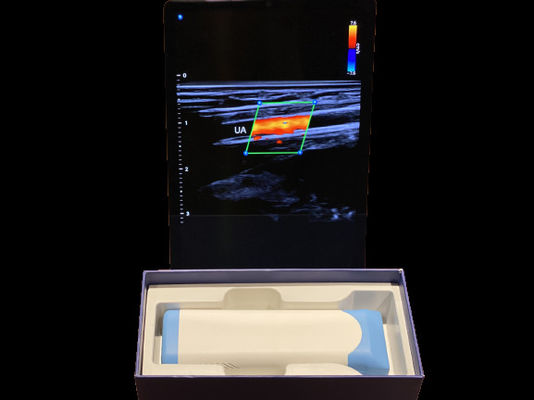 satın al Gelişmiş El Ultrason Tarayıcısı 0.2kg 3000mAh Pille Tıbbi online manufacture