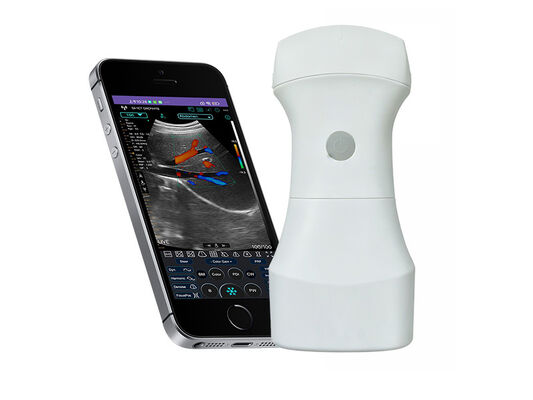satın al Taşınabilir Klinik Görüntüleme için Değiştirilebilir Pilli Kablosuz Cep Dışbükey Ultrason Tarayıcı online manufacture