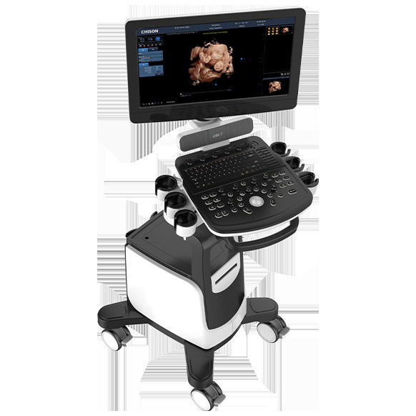 19 İnç LED Renkli Doppler Ultrason Makinesi Chison QBit 7