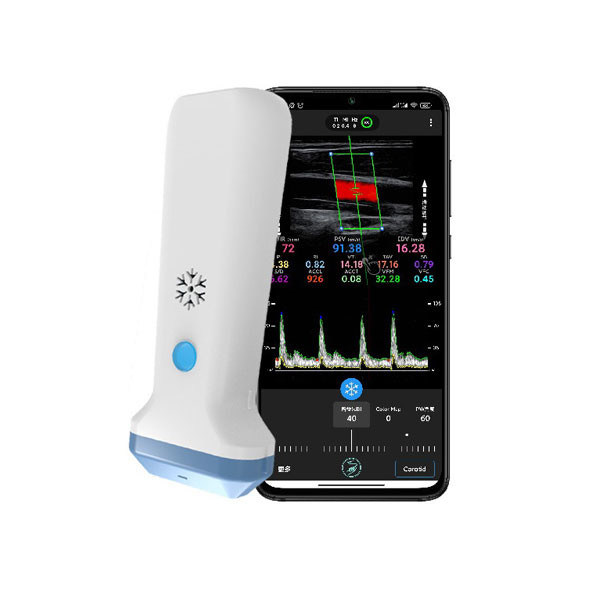Kablosuz Doğrusal El Ultrason Tarayıcısı | 4/8.3/12MHz Taşınabilir Renkli Doppler Ultrason Probu