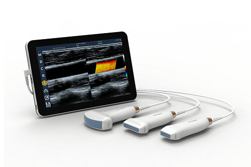USB Tip-C Doğrusal El Tipi Ultrason Tarayıcı Vasküler ve POCUS için 10MHz Taşınabilir Android Ultrason Probu