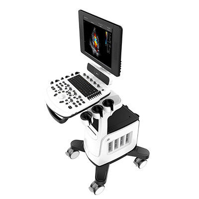 15 İnç LED'li Renkli Doppler Ultrason Tarayıcı Chison Qbit 5