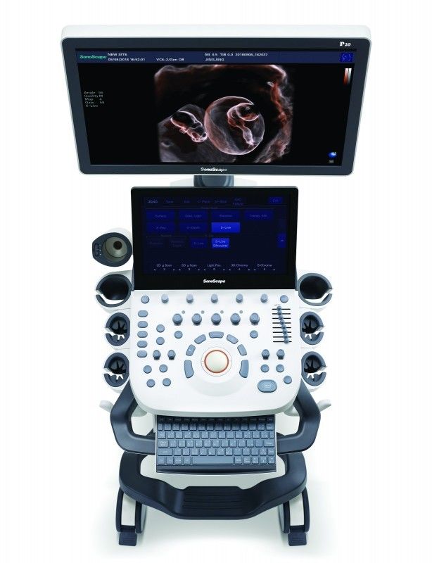 21,5'' LED Sonoscape P10 Arabalı Renkli Doppler Ultrason Makinesi