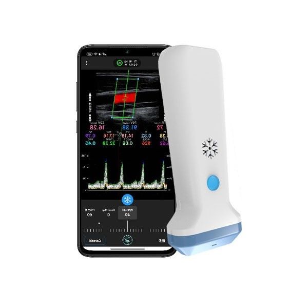 Sağlık Profesyonelleri İçin 12.6cm Taşınabilir Renkli Doppler Ultrason Tarayıcı