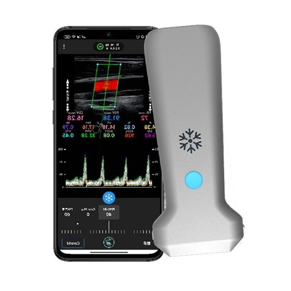 CE Sertifikalı Kablosuz Doğrusal El Tipi Ultrason Tarayıcı | 8.3MHz Taşınabilir Renkli Doppler Ultrason Probu