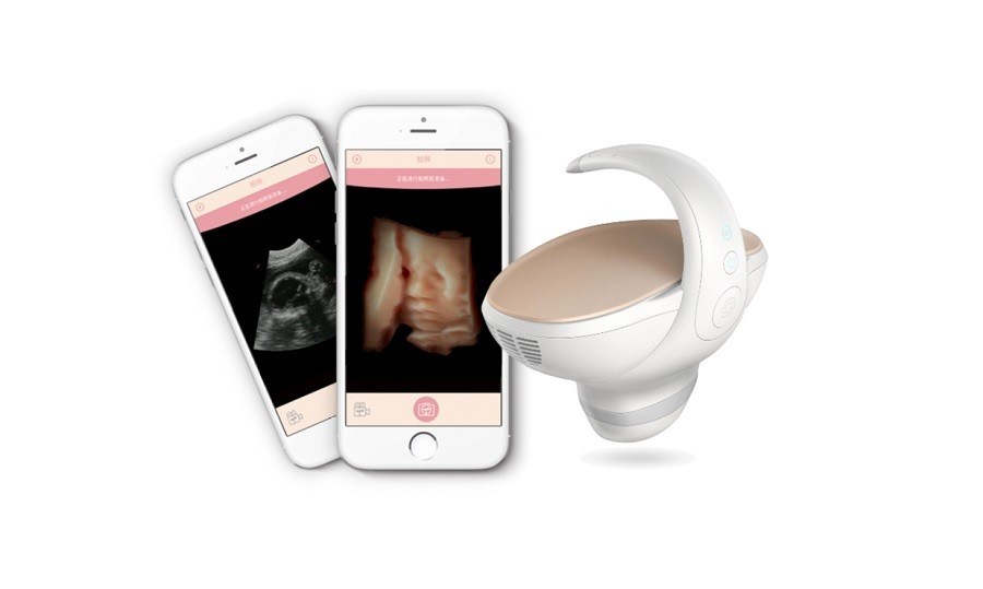 CE Onaylı 3D/4D Elde Taşınabilir Fetal Ultrason Tarayıcısı
Taşınabilir Hamilelik Görüntüleme Çözümü 60° Geniş Açılı Konveks Sonda