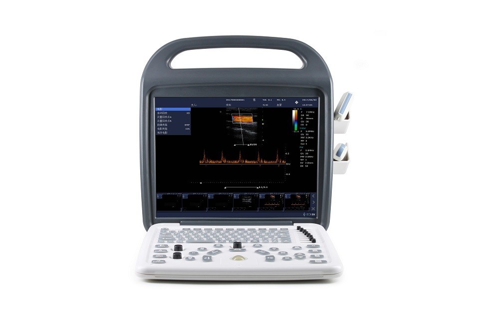 Kadın Doğum/GYN, Abdomen ve Kardiyak Görüntüleme için 15 inç HD Ekranlı DCU10 Taşınabilir Renkli Doppler Ultrason Sistemi