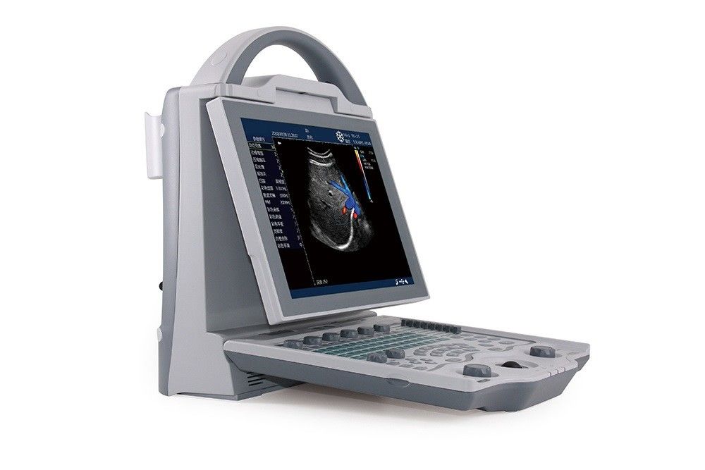 Gebelik için 16GB Giriş Seviyesi 2D Dizüstü Renkli Doppler Ultrason Sistemi